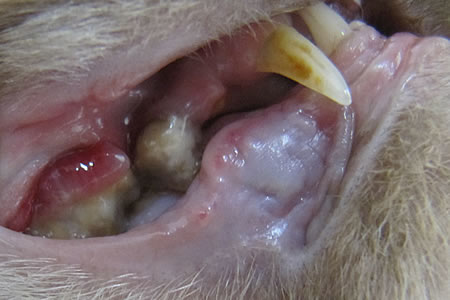 歯垢・歯石の付着を認めた右上顎前臼歯と、歯肉炎を起こした歯肉